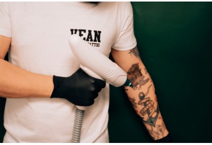 Tatuiruočių šalinimas lazeriu salone „VEAN TATTOO & PIERCING“